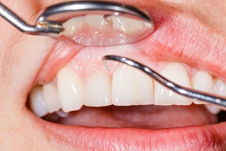 ten facts about gums